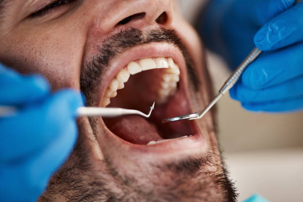 Best Emergency Dental Care for Sports Injuries in East Uniontown, PA